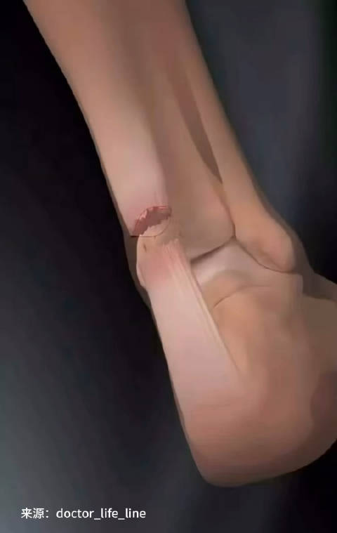 缝合身首，在断裂处重寻完整的我